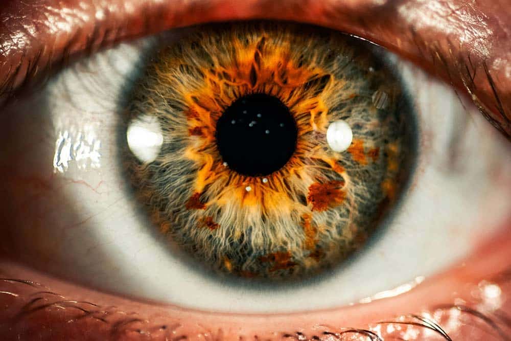 Lentes intraoculares trifocales